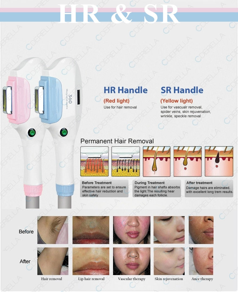 4 in 1 OPT IPL Laser SHR Multifunction System Fast Painless Hair Removal, Skin Rejuvenation, Whiten Nd Yag, Tattoo Remove Machine